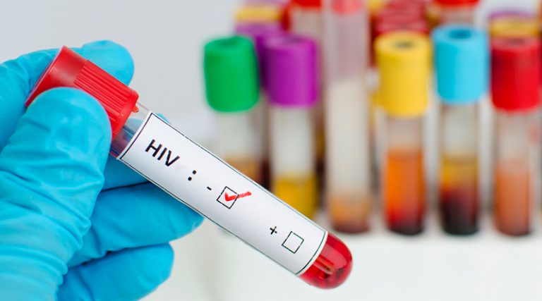 Брчко: Бесплатно тестирање на HIV и хепатитис Б и Ц