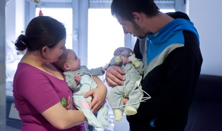 Медицинско чудо у Загребу: 14 доктора успјешно раздвојило сијамске близанкиње