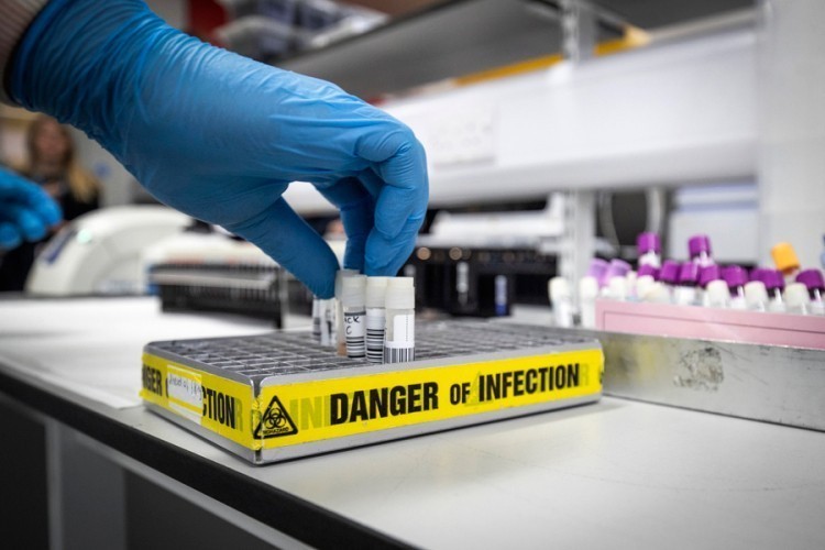 24 nova slučaja zaraze virusom korona u Brčkom