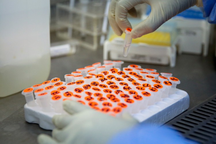 Четири нова случаја заразе коронавирусом у Брчком