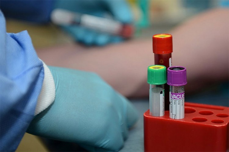 Коронавирус у Брчком: 43 нова случаја заразе, преминула 1 особа
