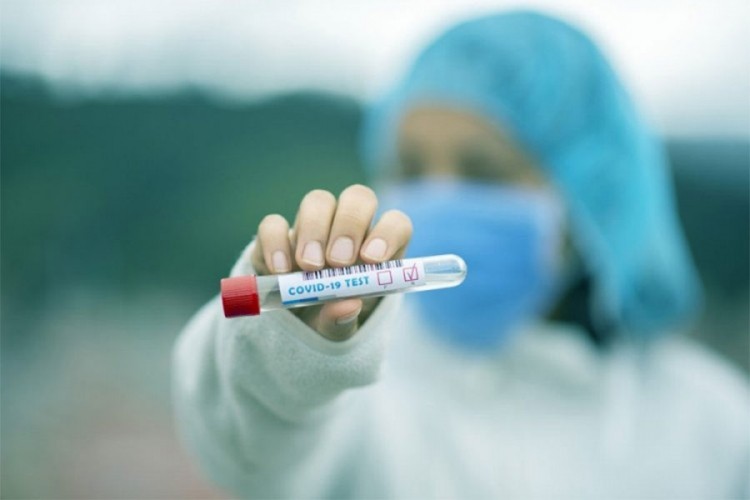 16 нових случајева заразе вирусом корона у Брчком, преминуле двије особе