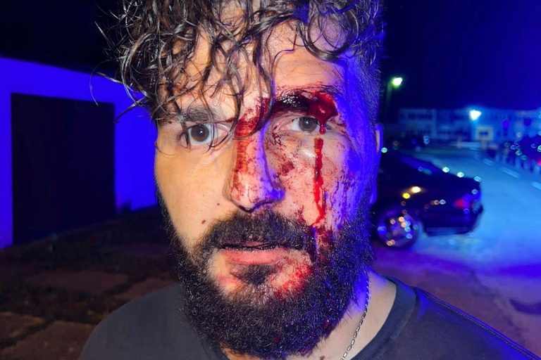 Новинар из Брчког у сачекуши нападнут и претучен