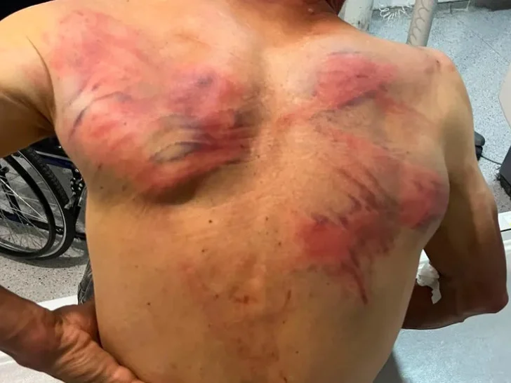 Tzv. kosovska policija pretukla Nenada Raškovića
